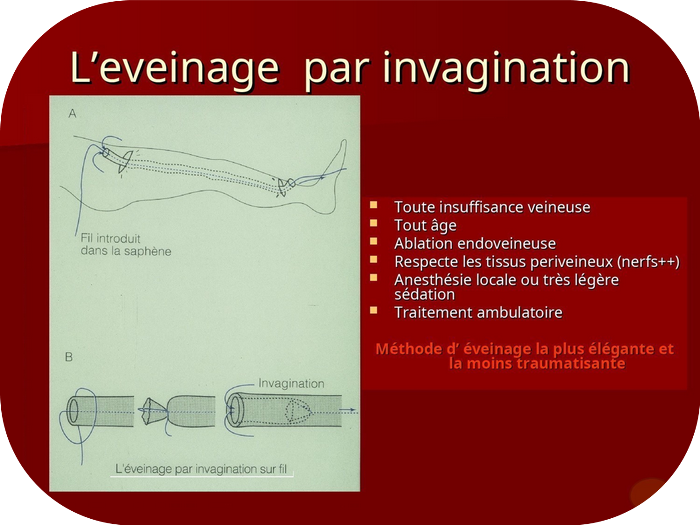 Eveinage par invagination