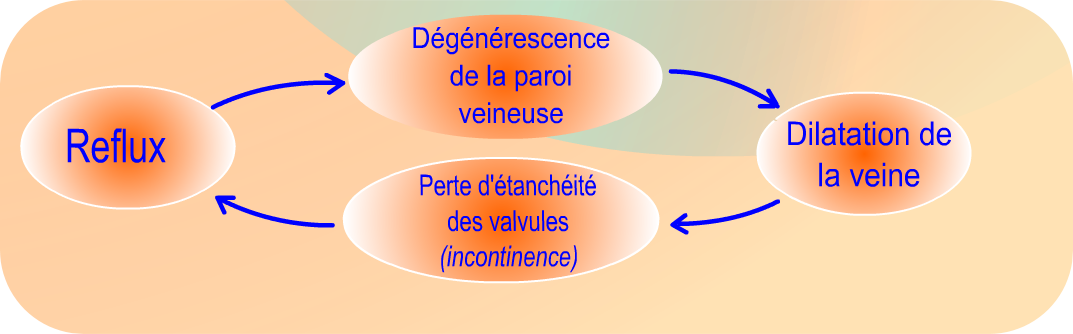 Schéma reflux degenerescence perte dilatation