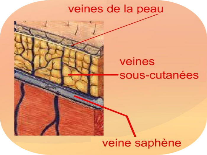 Schéma varices varicosités
