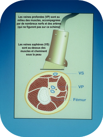 Sch&eacute;ma veines