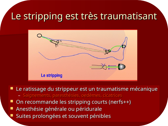 stripping tr&egrave;s traumatisant