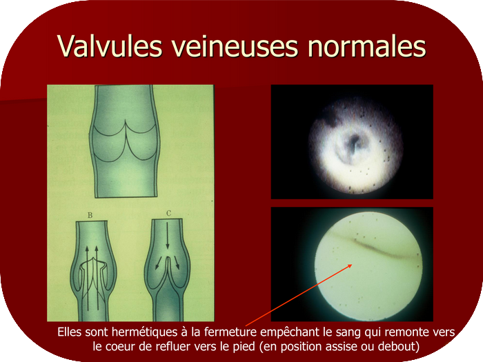 Valvules veineuse normal