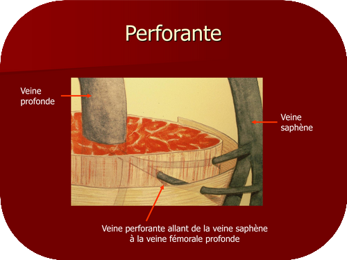 Veines perforantes